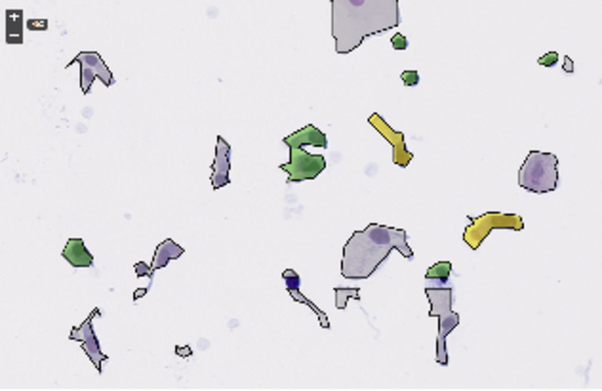 Workflows for sorting various types of cells