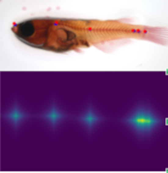 Anatomical landmark detection algorithms