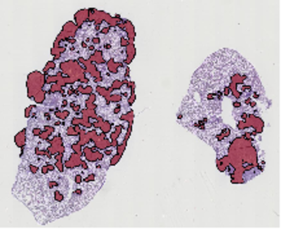 Image segmentation techniques